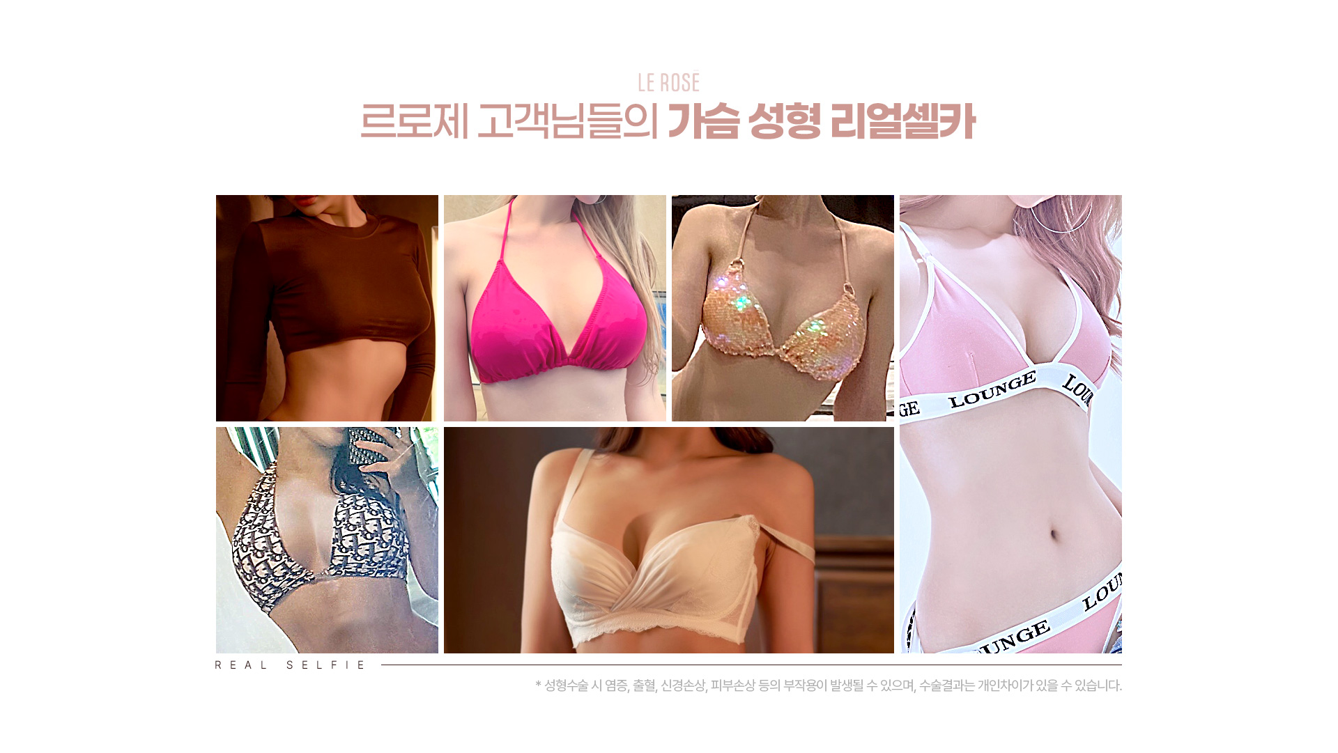 가슴성형 리얼셀카