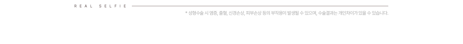 가슴성형 리얼셀카 하단