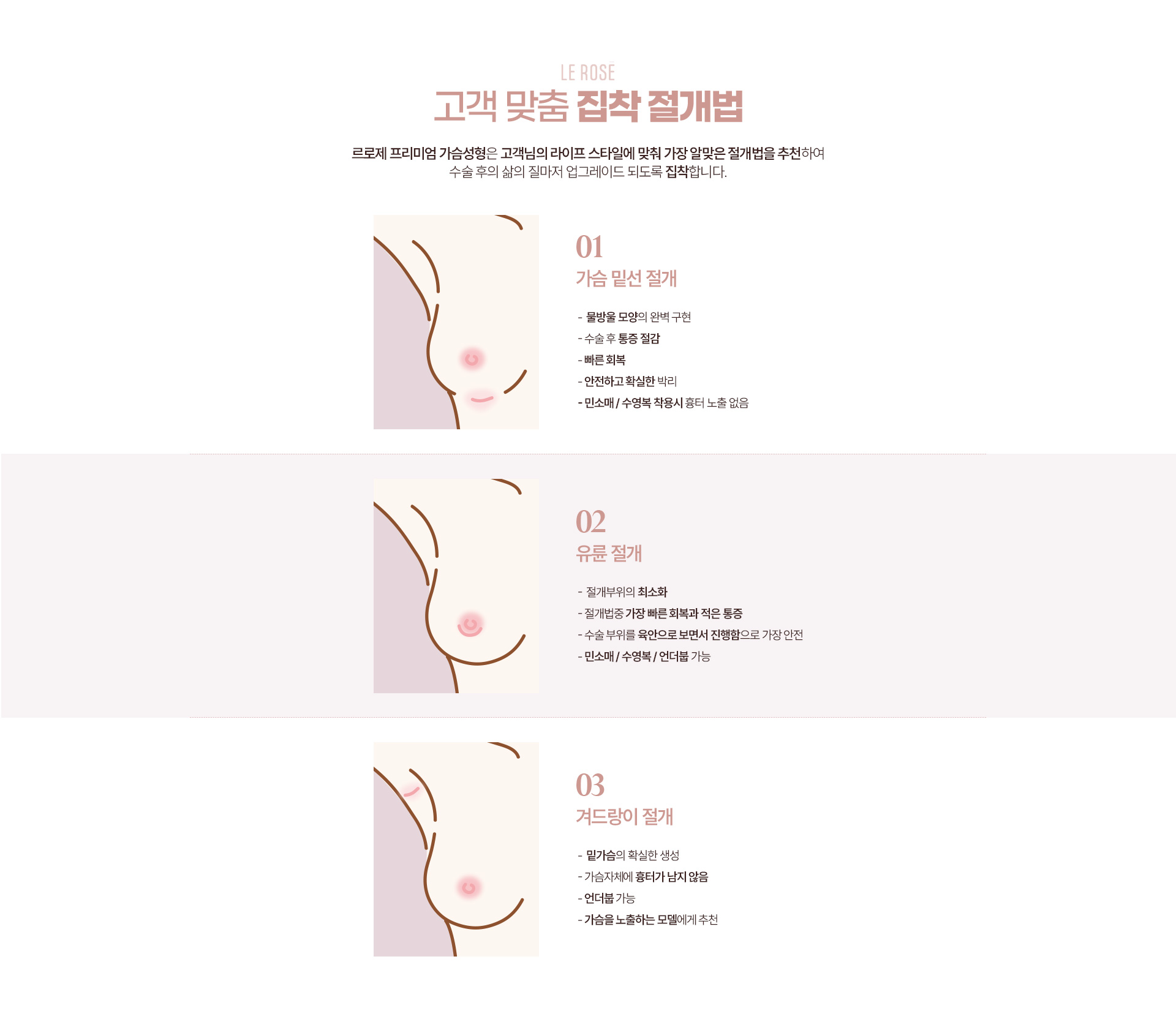 가슴성형 절개법