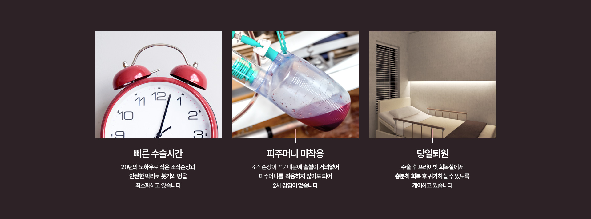 가슴성형 장점