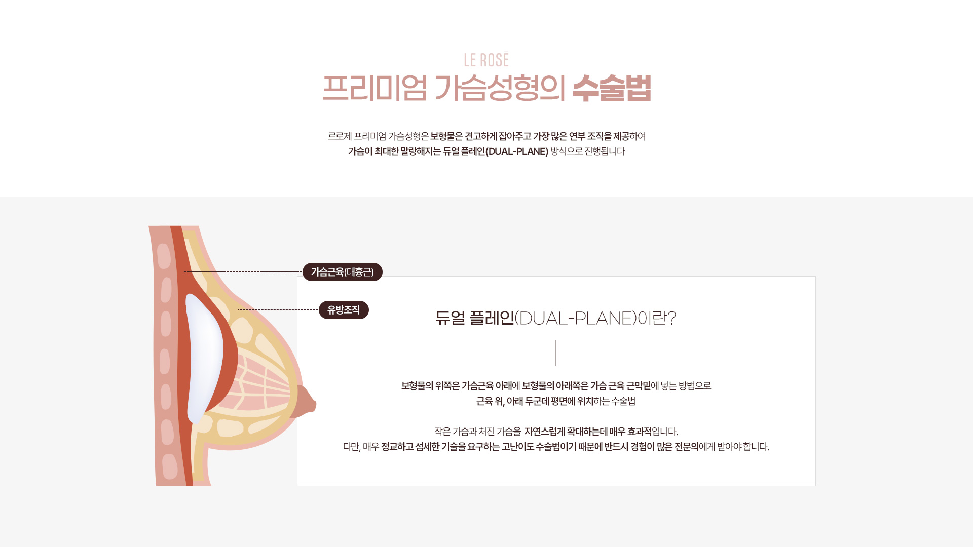 가슴성형 수술법