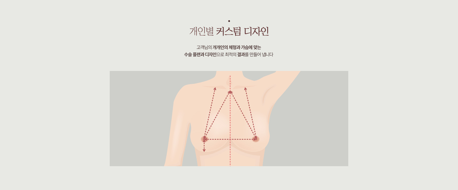 멘토 커스텀디자인