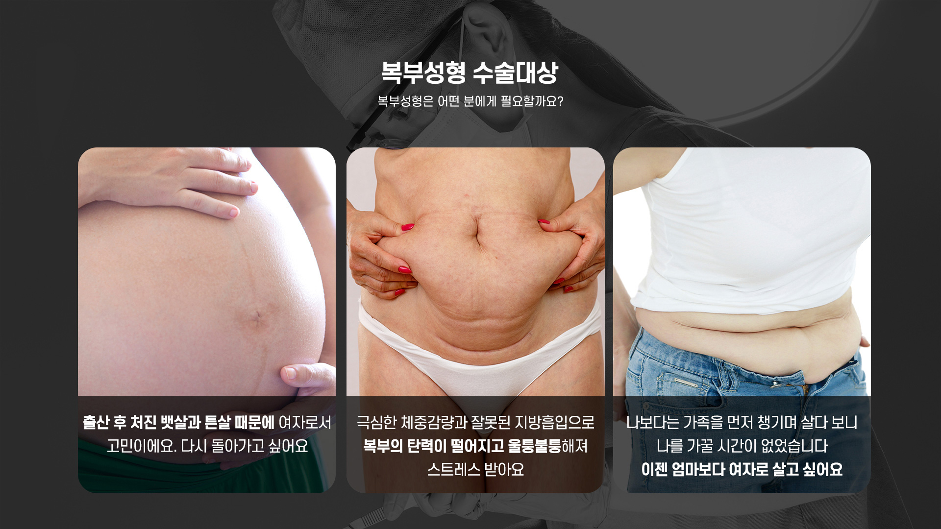 복부거상 수술대상