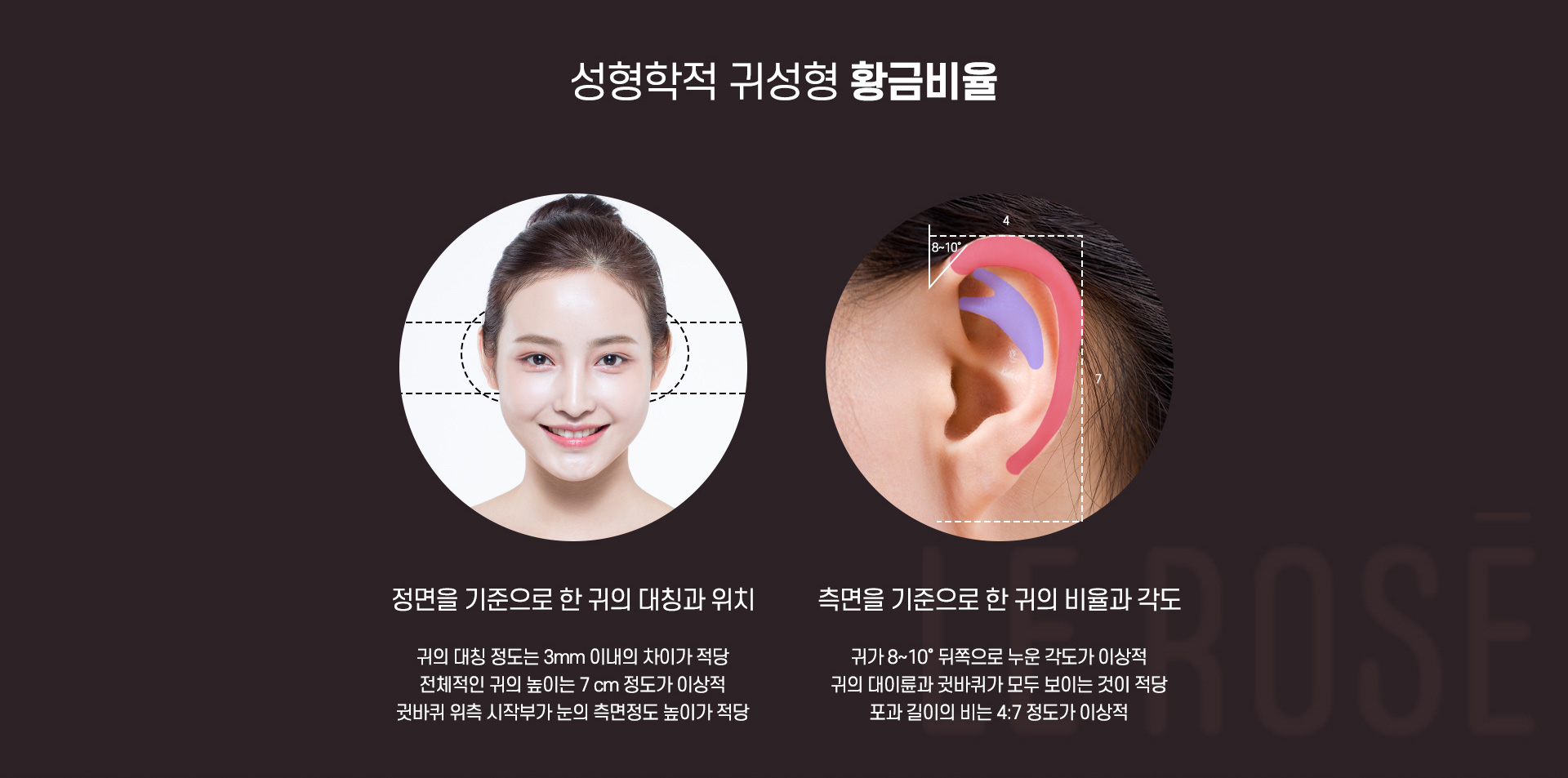 귀성형 황금비율
