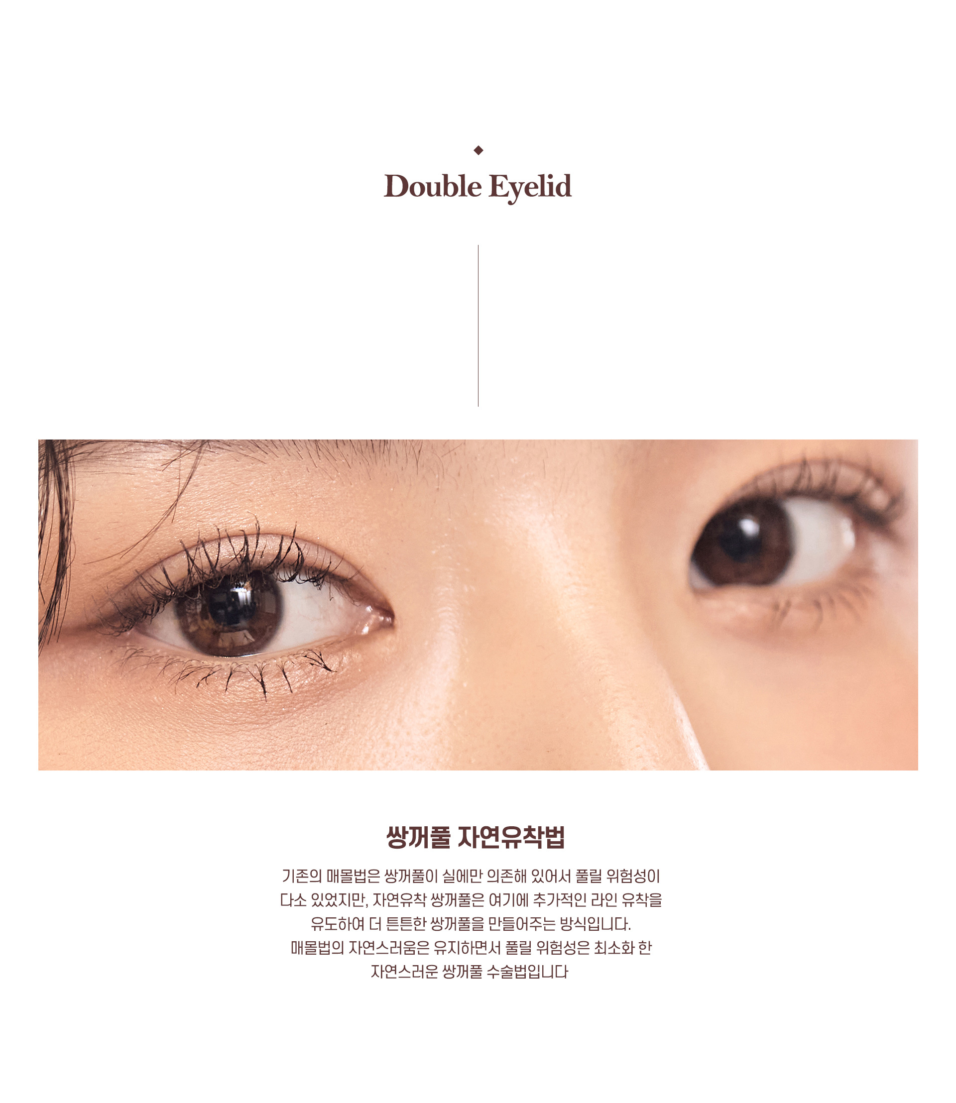 자연유착쌍꺼풀 정의