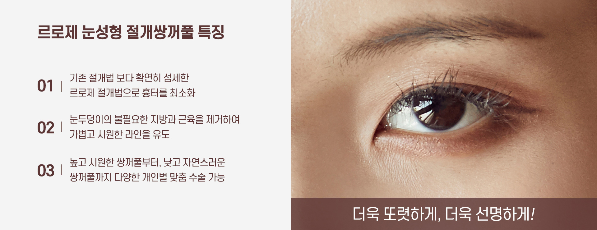절개쌍꺼풀 특징