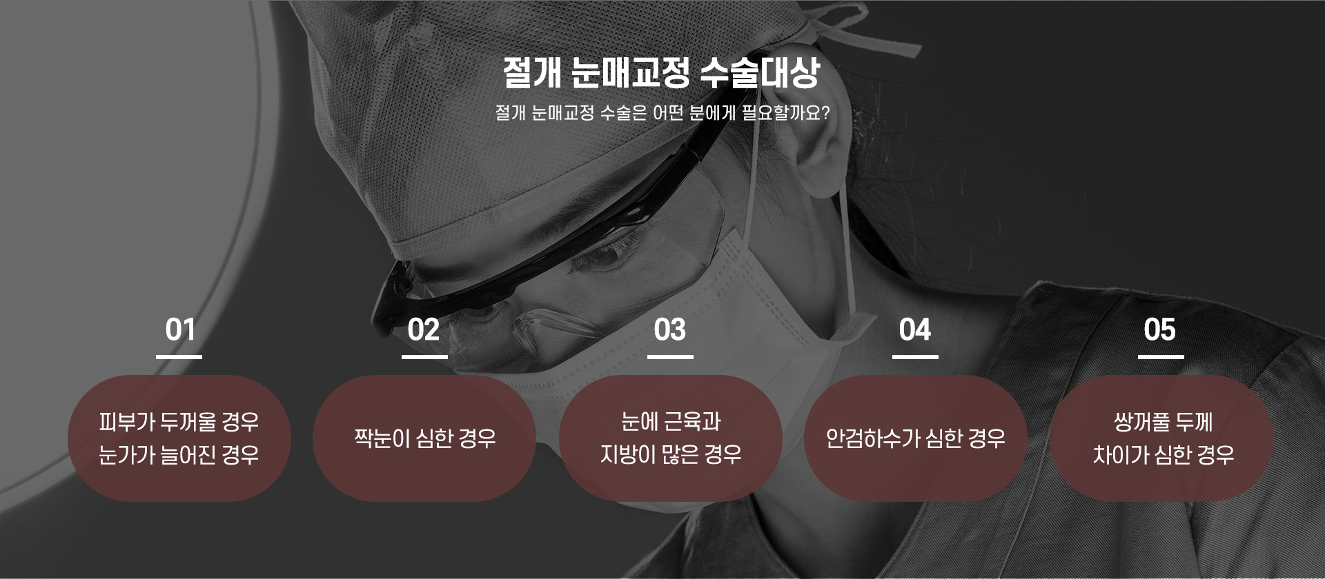 눈매교정 수술대상