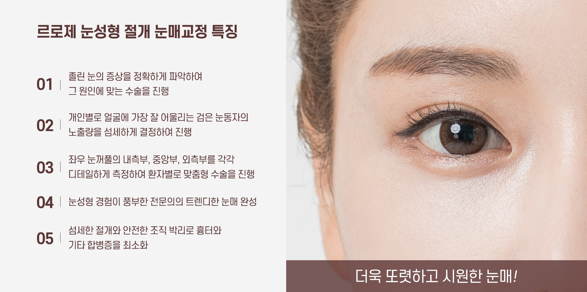 눈매교정 특징