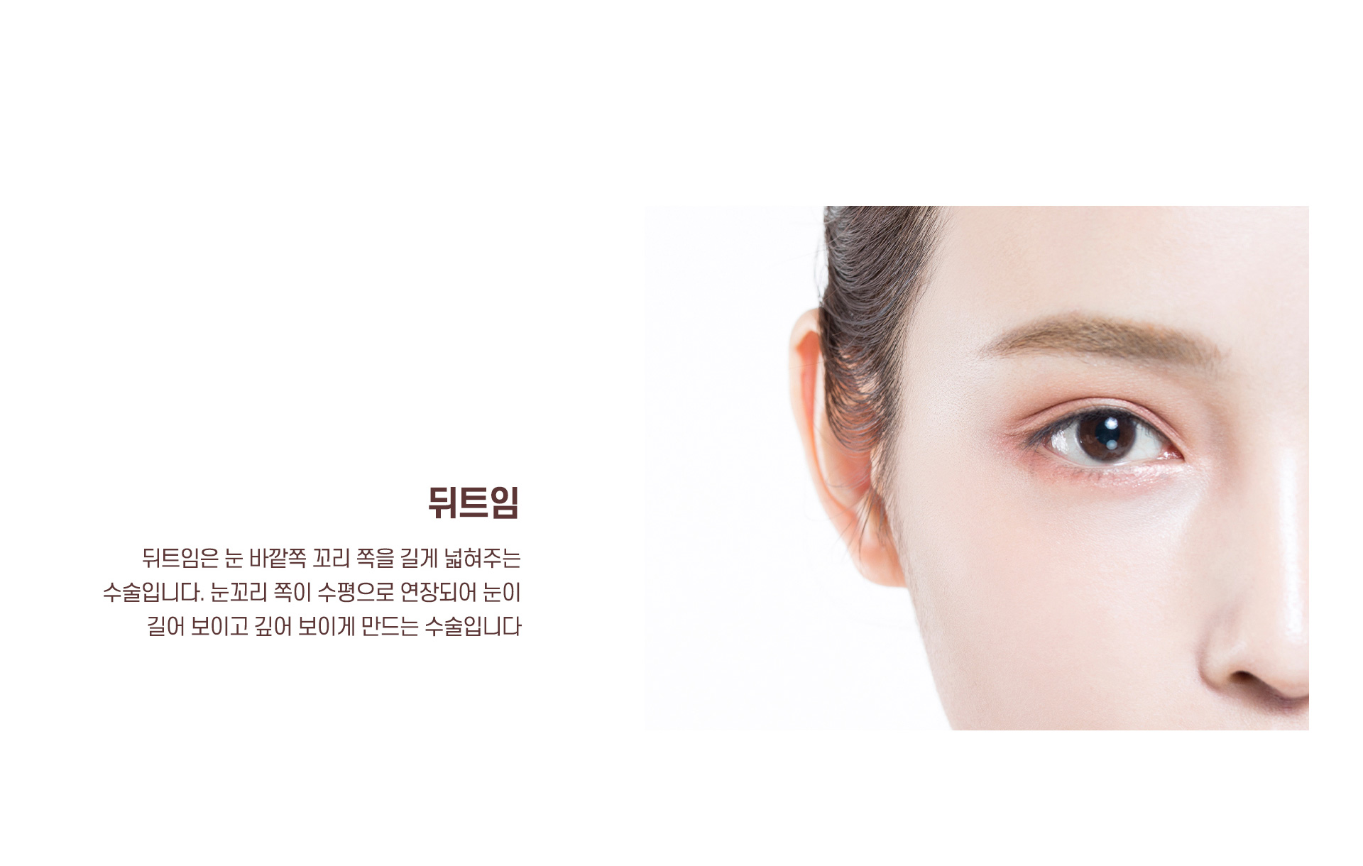 트임성형 뒤트임