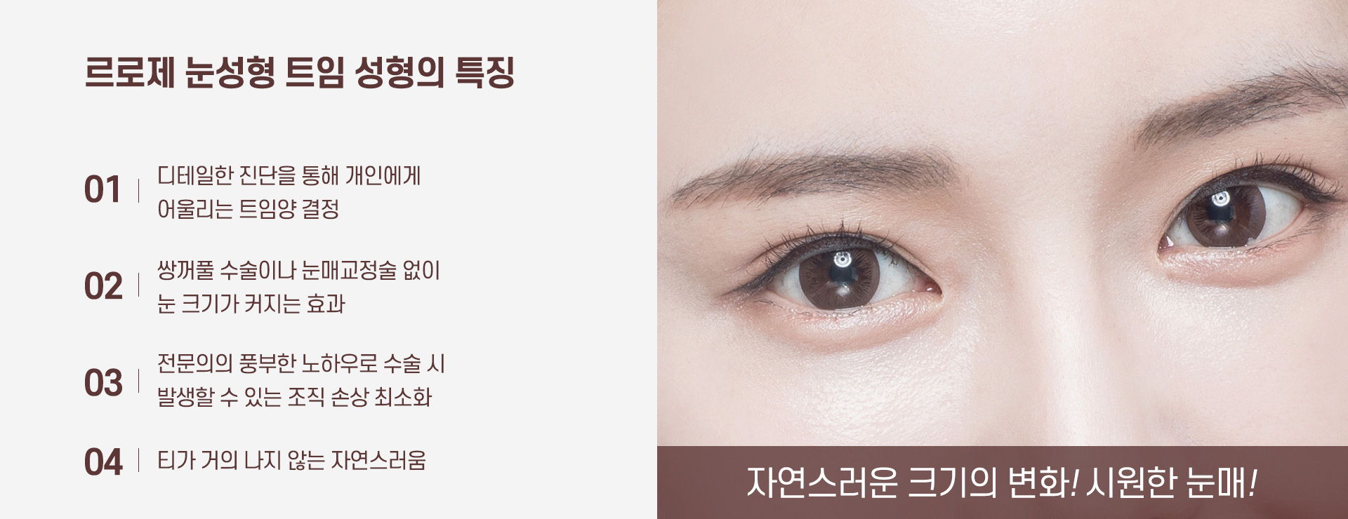 트임성형 특징
