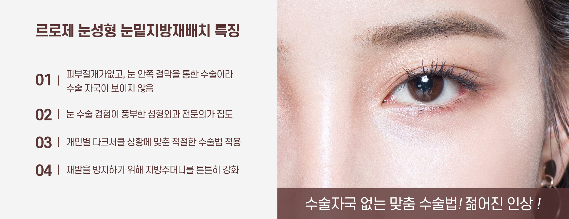 눈밑지방재배치 특징