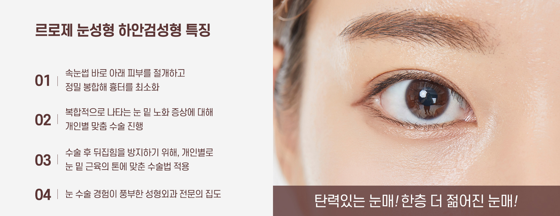 하안검성형 특징
