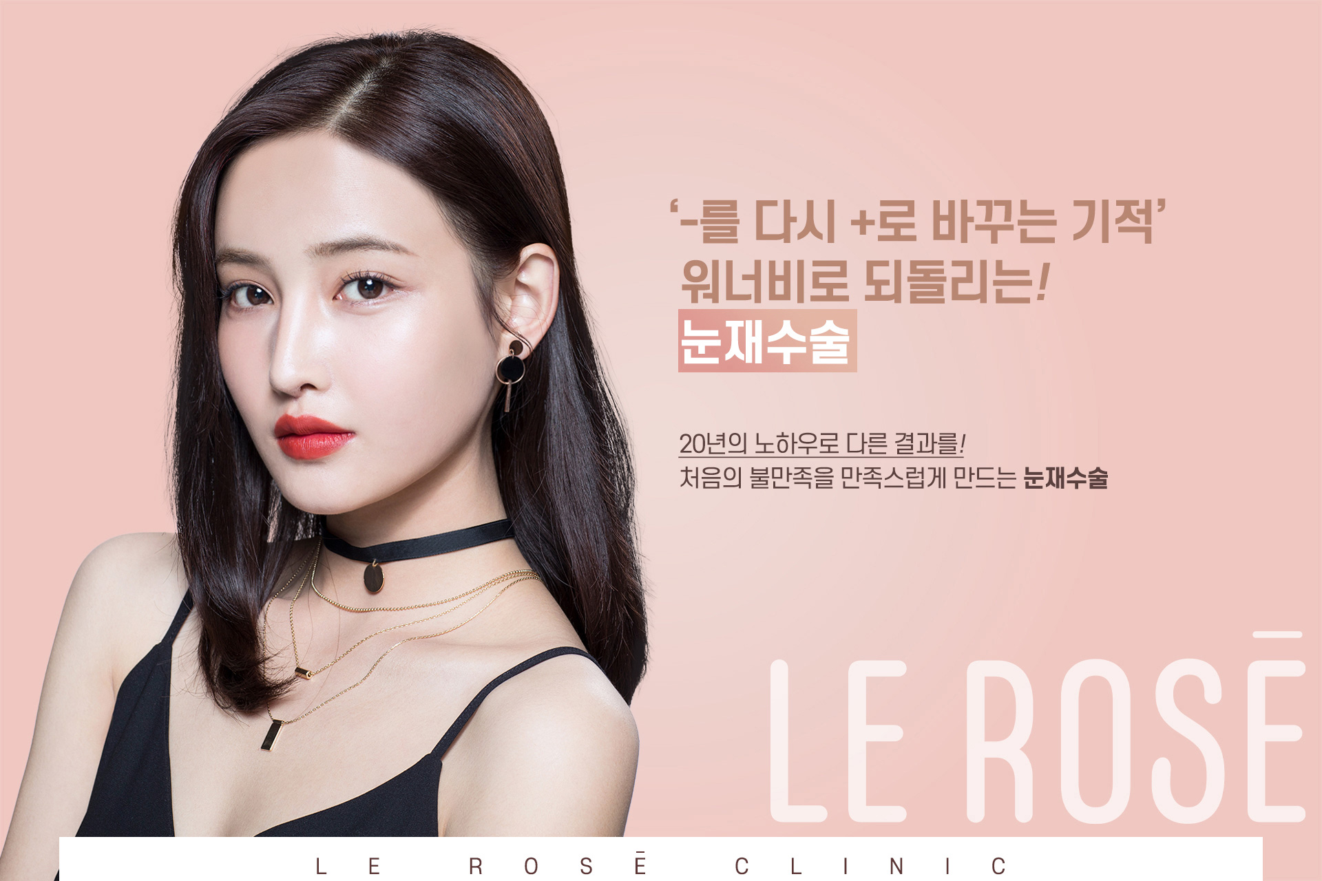 눈재수술 키비주얼