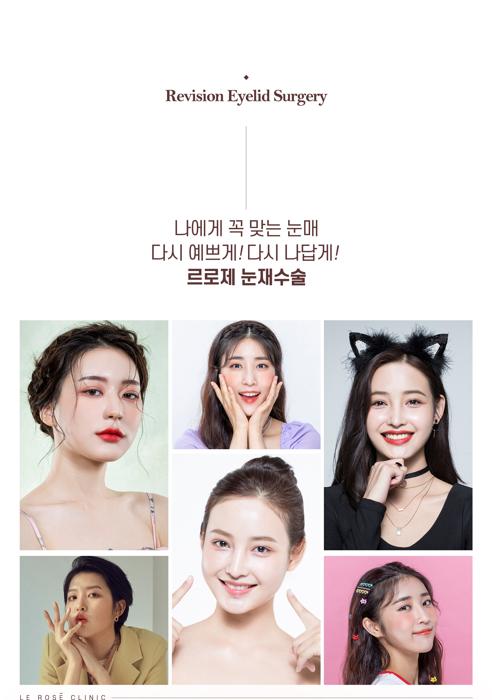 눈재수술 셀피