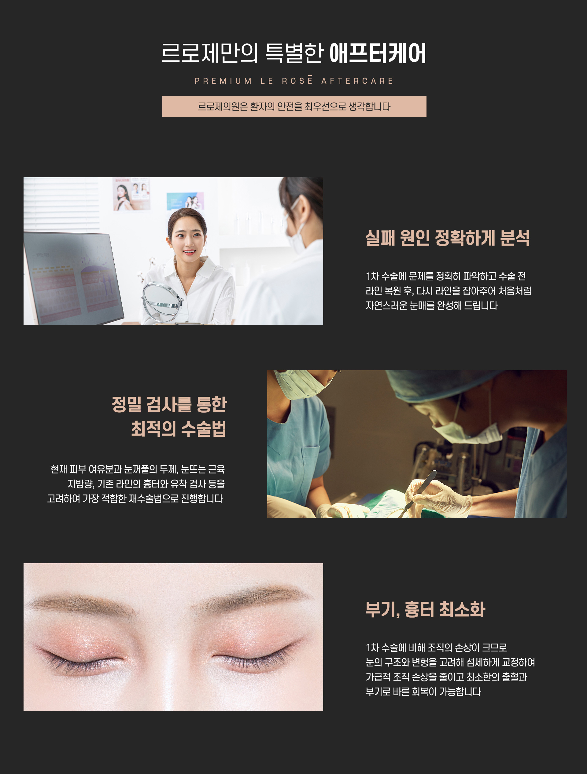 눈재수술 애프터케어